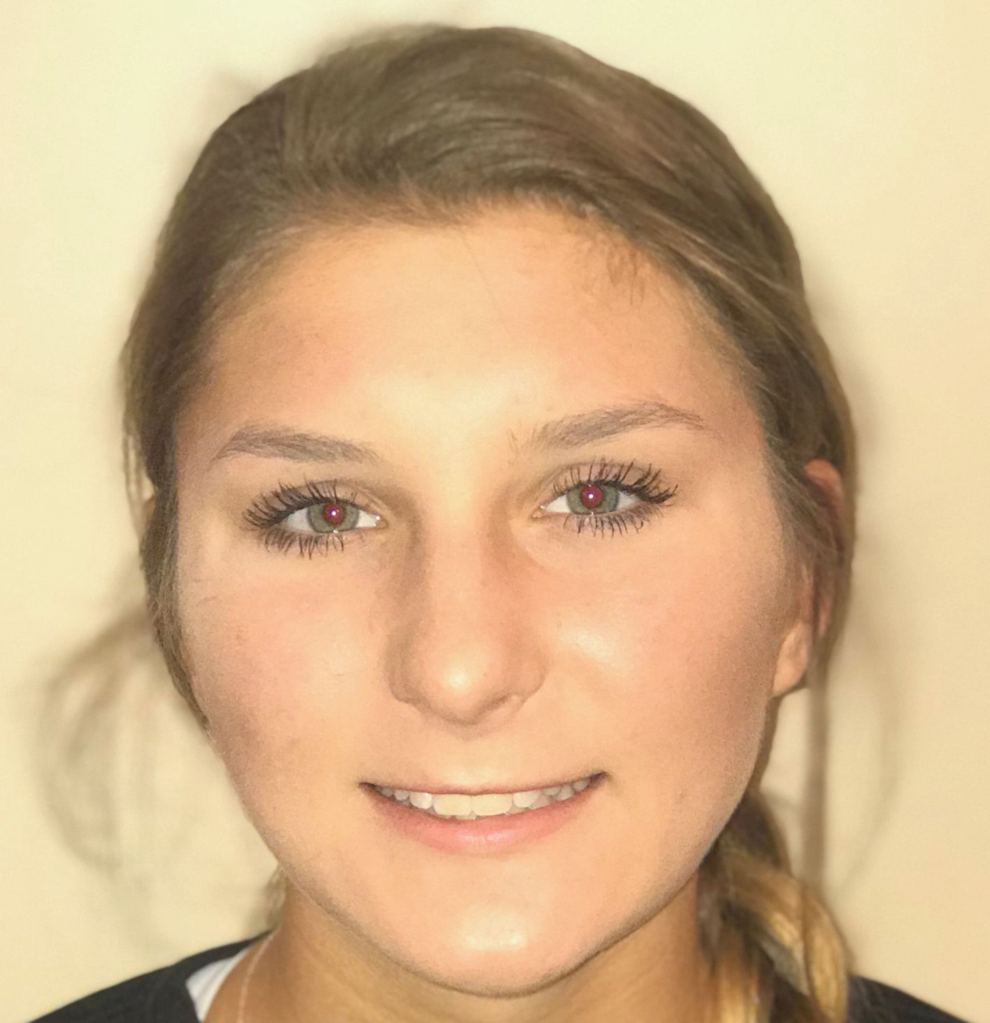 Lauren Ottensmeyer, Parkway West